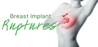 breast implant removal abroad